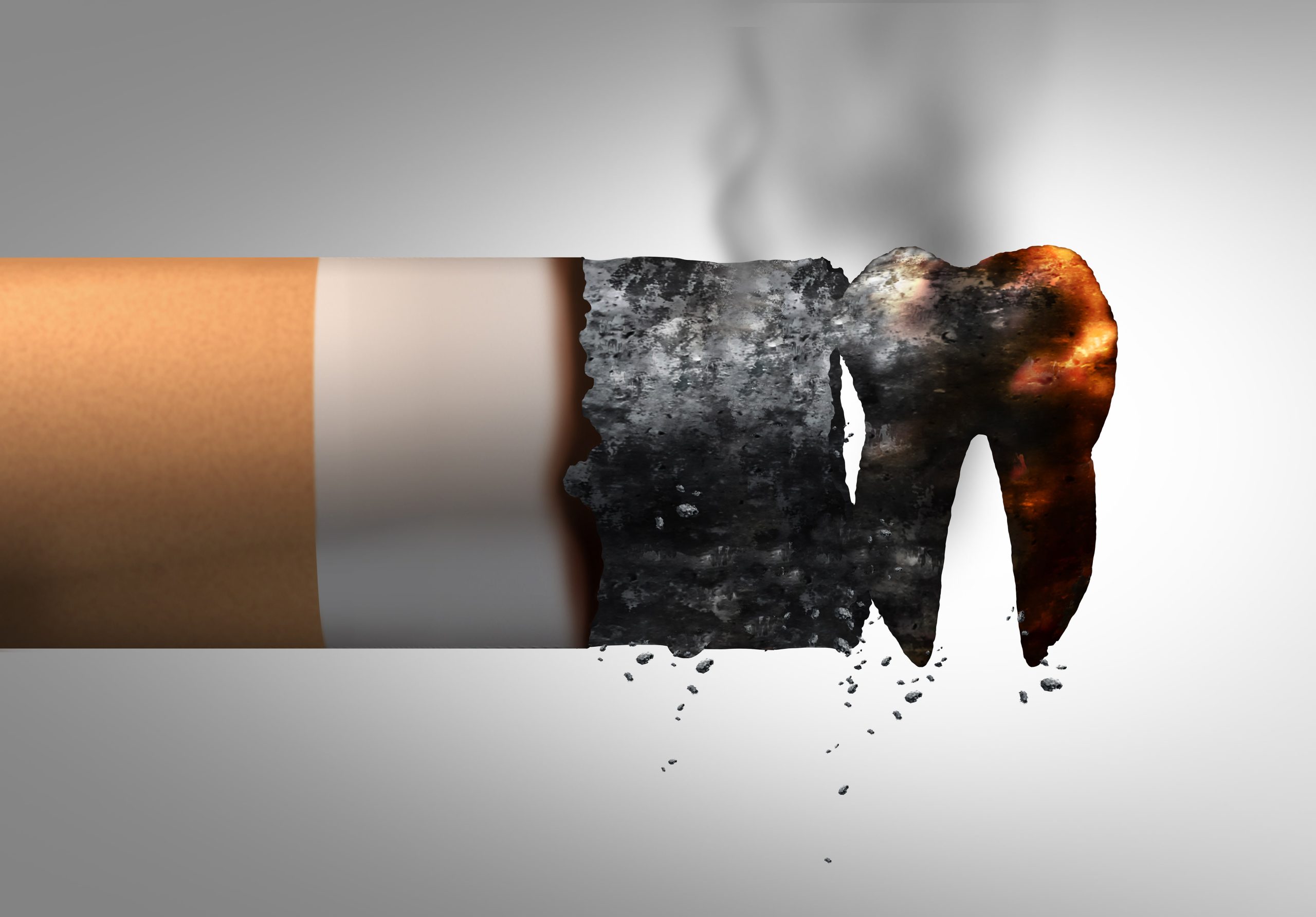 The Shocking Reality: How Smoking Fuels a Gum Disease Epidemic in London!